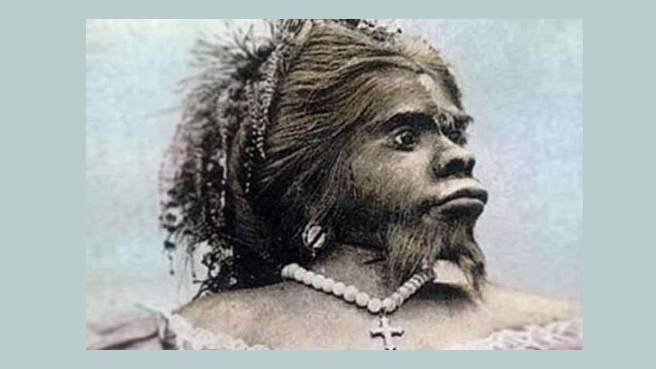 La triste historia de Julia Pastrana “La mujer mono”